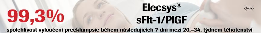 reklama